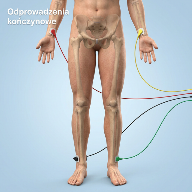 Widok układu elektrod kończynowych